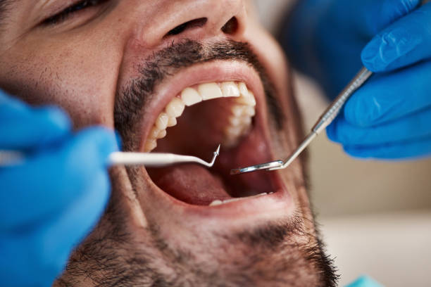 Best Pediatric Emergency Dentist in Oxford, OH