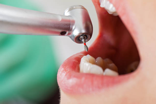 Best Emergency Treatment for Toothache in Oxford, OH